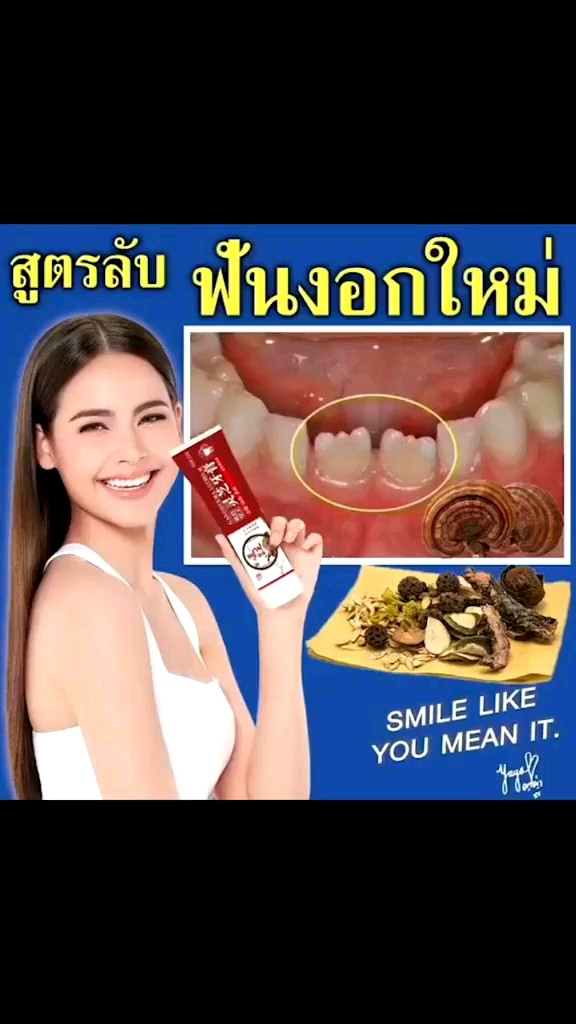 Ganoderma Lucidum Pasta Gigi ORI Penguat Gigi Goyang Menyembuhkan Sakit Gigi Berlubang