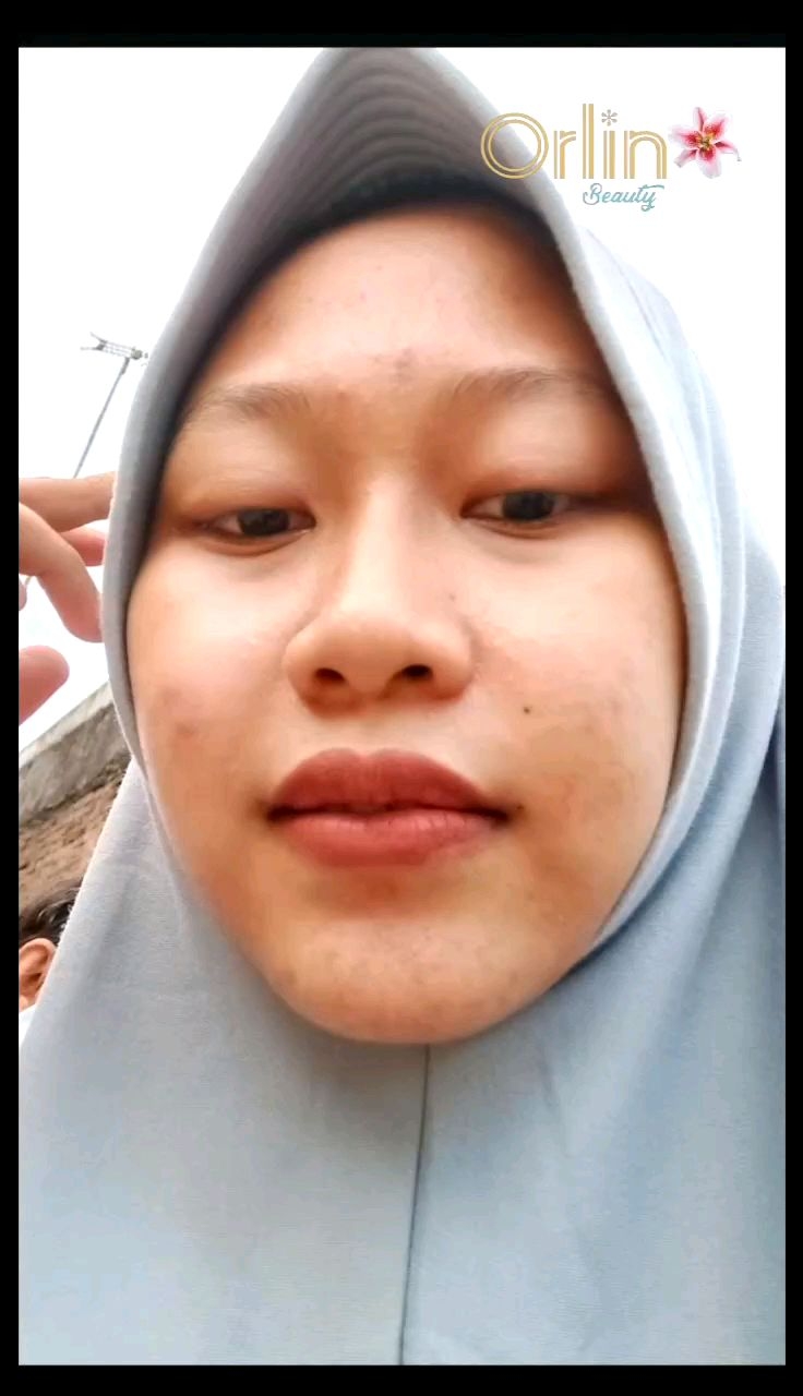 Day Flek Orlin Beauty Skincare Bpom Memudarkan Flek Hitam Mencerahkan Wajah Bebas Flek Bandel