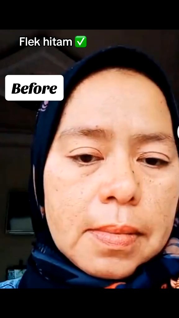 Paket Skincare Flek Platinum & Serum Anti Aging Mencerahkan Wajah