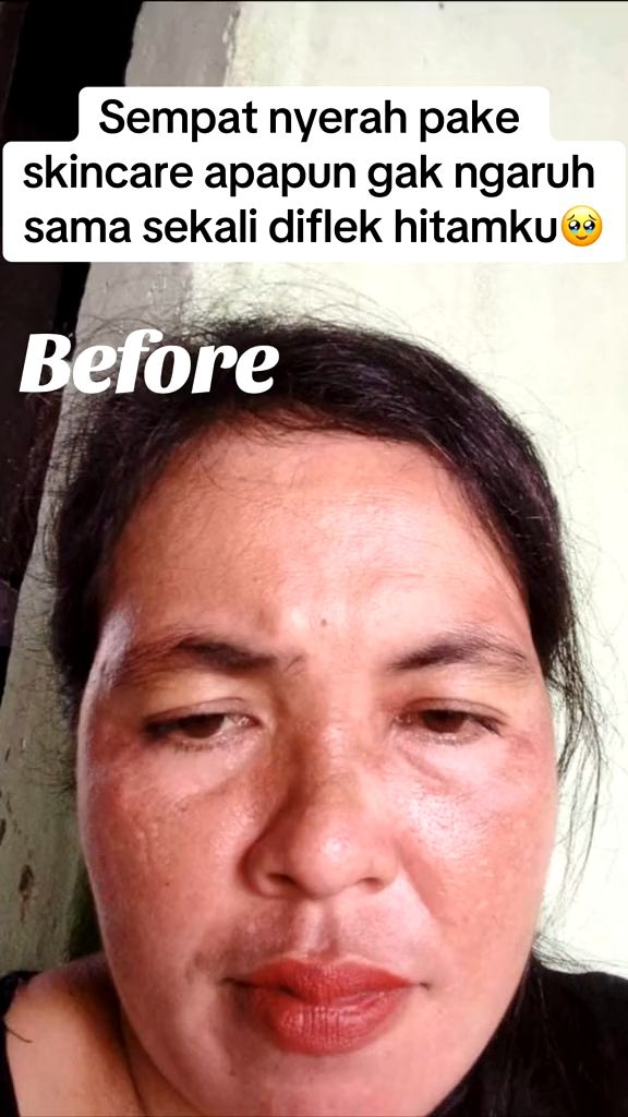 Orlin Beauty Skincare Paket Flek Platinum Mencerahkan Wajah Mengencangkan Kulit Memudarkan Flek Hitam Skincare BPOM