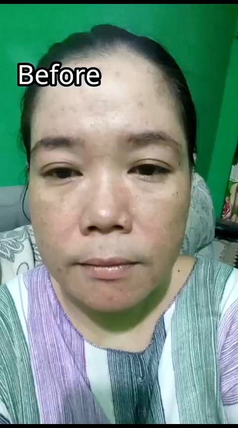 Orlin Beauty Serum Flek Mengencangkan Kulit Menyamarkan Flek Kerutan Wajah Anti Aging Skincare